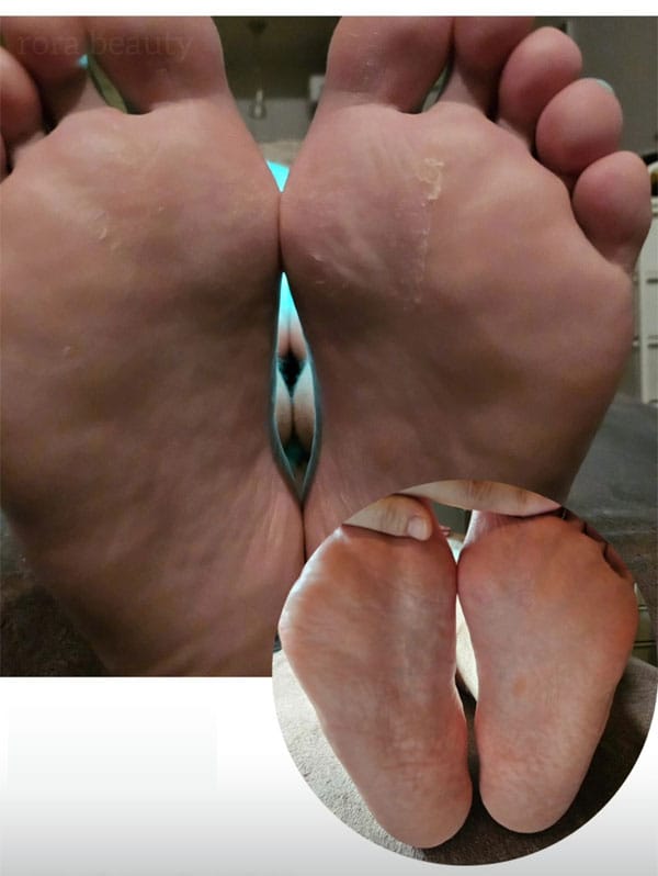 로라뷰티 실사진 2